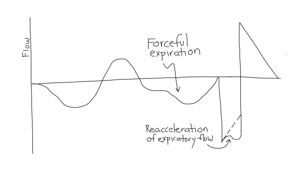 APRV_Forceful_Expirations