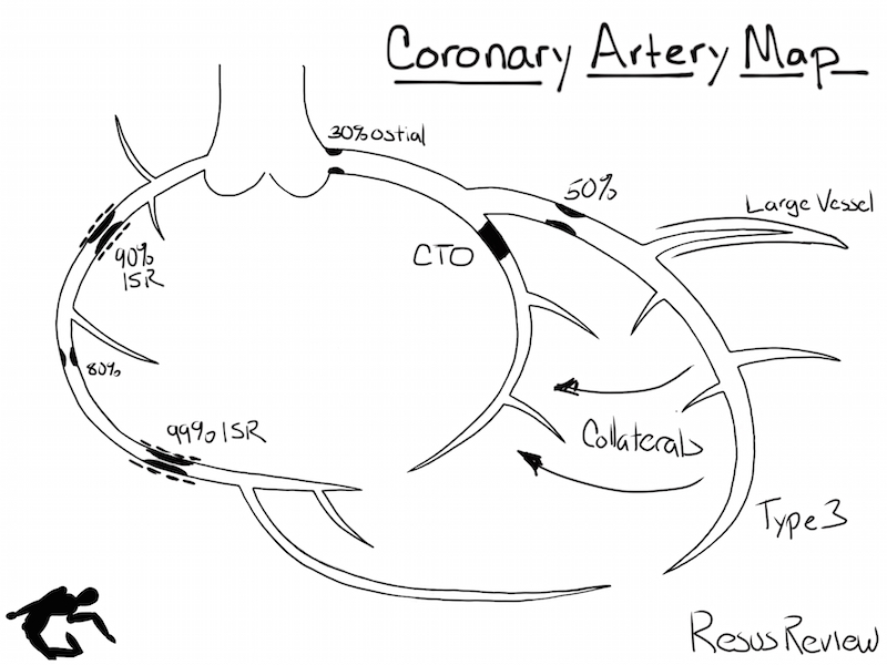 Example-Coronary-Artery-Markup