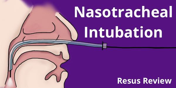 Learning and Mastering Nasotracheal Intubations