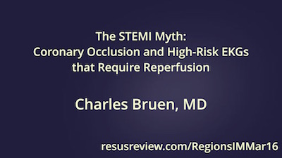 Bruen-RegionsIMMar16-STEMI-Myth-High-Risk-ECGs-Presentation